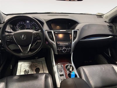 2015 Acura TLX V6 Tech